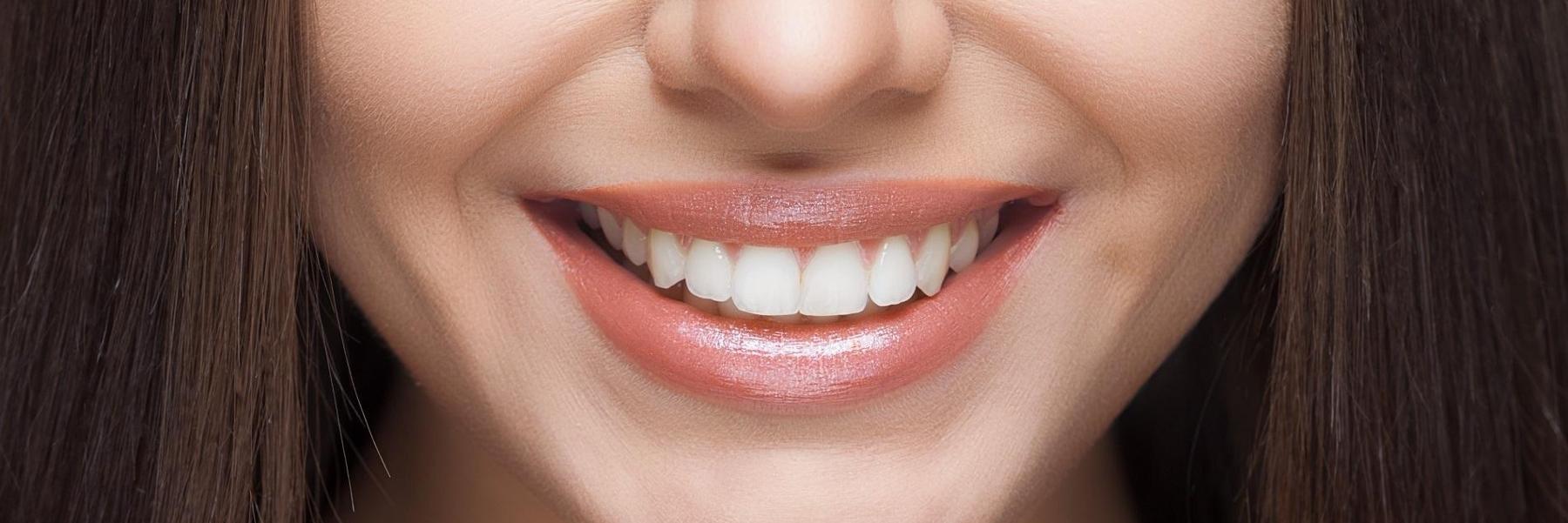 girl smiling after teeth cleaning in west chester oh 