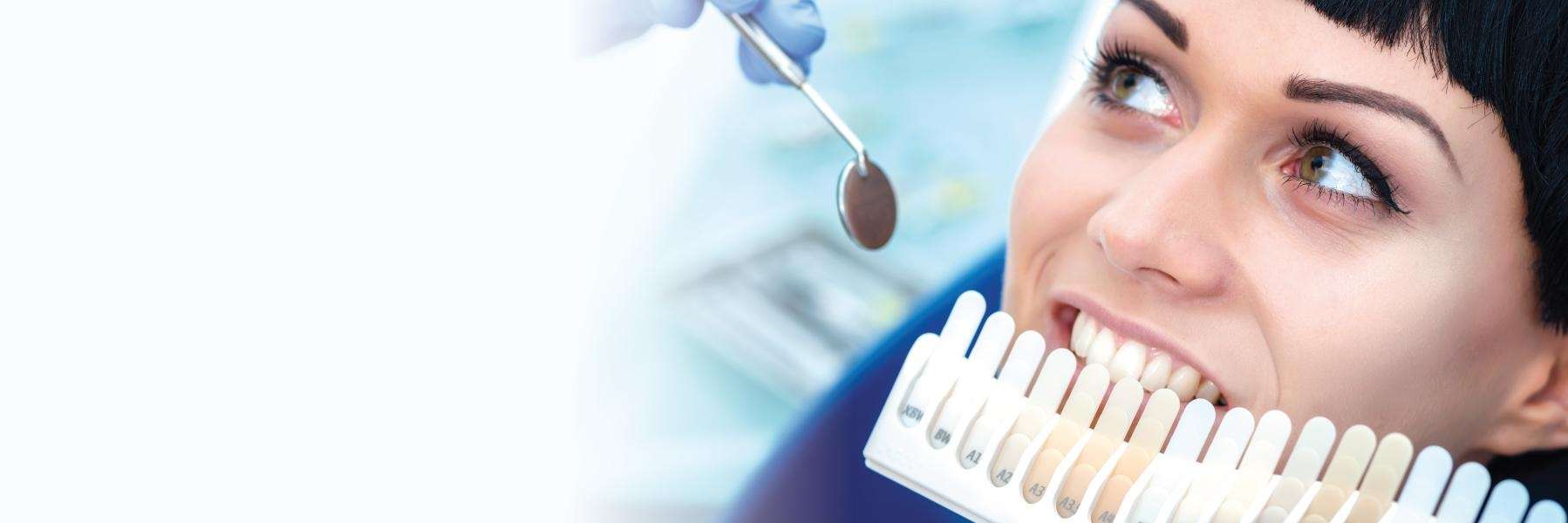 teeth whitening shade guide in West Chester OH