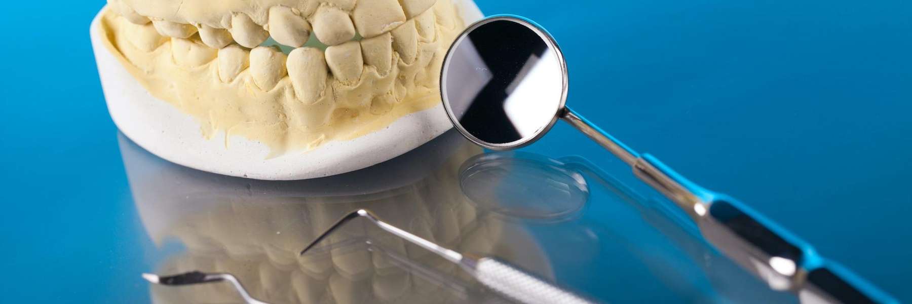 close up of mouth mold | dentist west chester oh